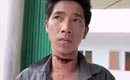 男子遭妻割喉淡定受访