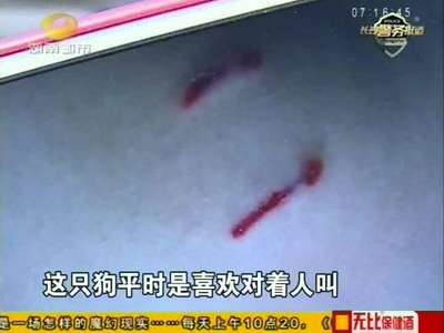 路人被狗咬伤 狗主人担责注射疫苗