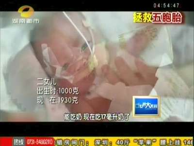 五胞胎求生记：早产五胞胎 小女儿不幸夭折