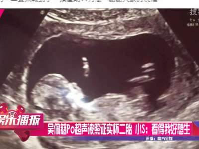 [视频]吴佩慈Po超声波照证实怀二胎 小S：看得我好想生