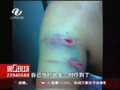 株洲：恶犬咬伤怀孕5月孕妇 