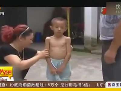 [视频]男孩三年只喝水不吃饭 无奈被母亲拴在树上