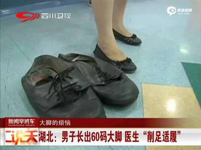 [视频]湖北男子长出60码大脚 医生手术“削足适履”