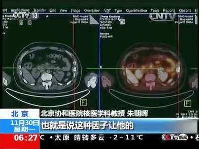 [视频]关注精准医疗 精准医疗：对症下药 精准诊断