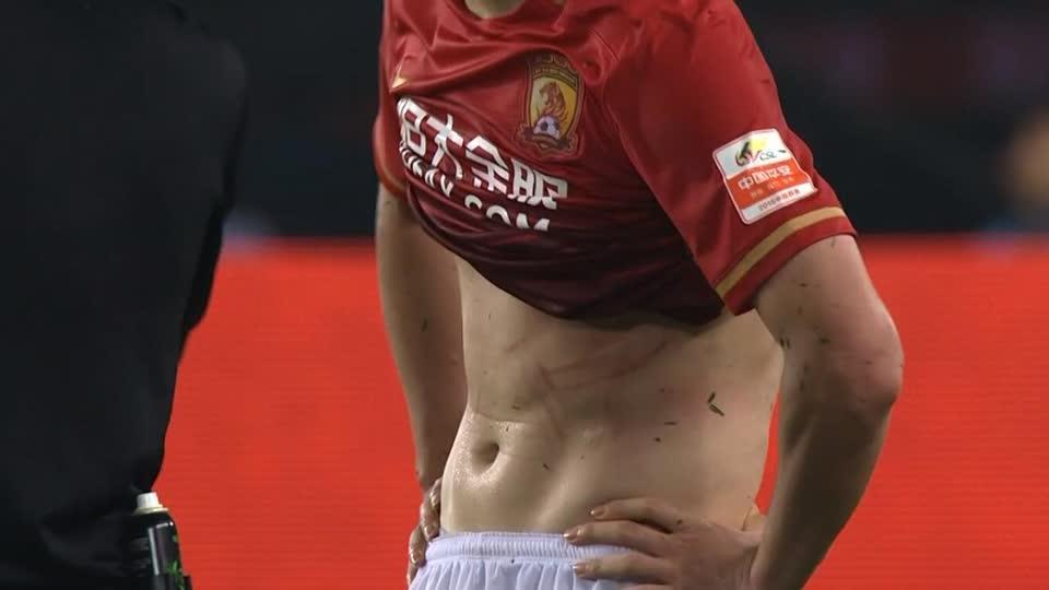 郜林遭前苏超悍将踩踏腹部 不满判罚掀衣露血