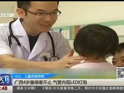 [视频]广西4岁童咳嗽不止 气管内现LED灯泡