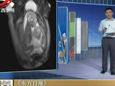 [视频]有图有真相！双胞胎竟在妈妈肚子里“打架”