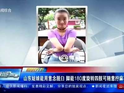 [视频]姑娘能用意念脱臼 脚能180度旋转四肢可随意拧麻花