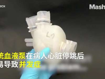 [视频]世界首个3D打印人工心脏问世，可持续跳动3000次