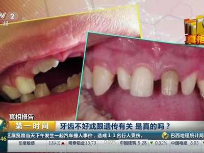 [视频]真相报告：牙齿不好或跟遗传有关 是真的吗？