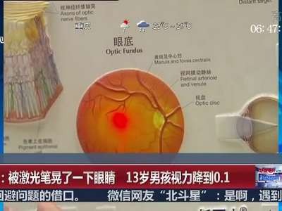 [视频]杭州：被激光笔晃了一下眼睛 13岁男孩视力降到0.1