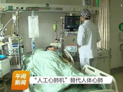 “人工心肺机”替代人体心肺
